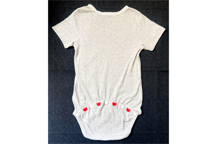 ハンディモア　脱げないロンパース開発しＷ受賞　コルネリア症候群、知的障害向けなど発売へ